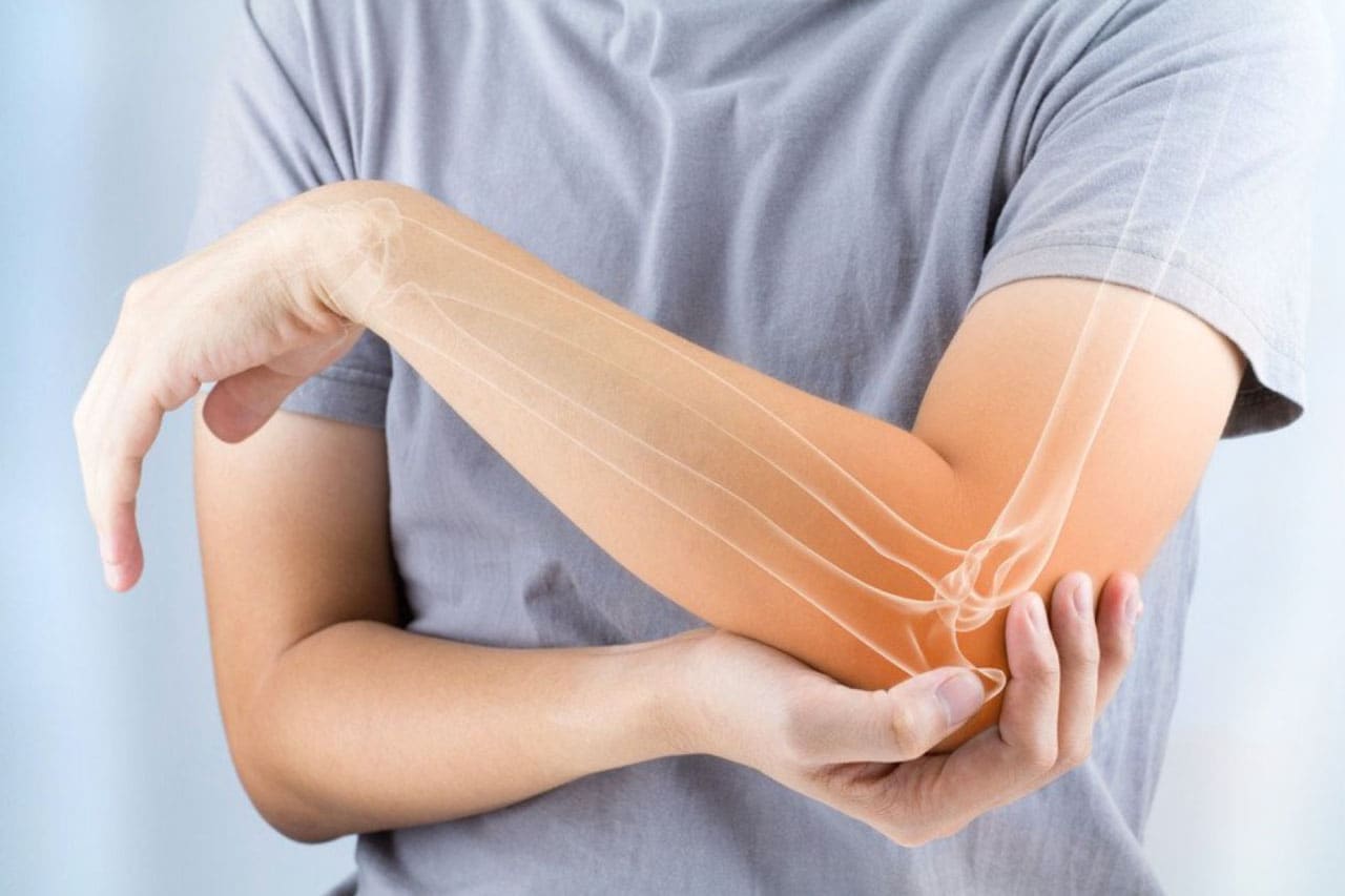 Osteoporose