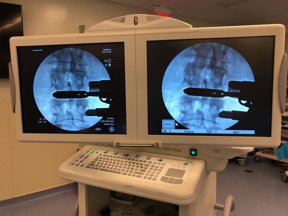 Aperfeiçoamento sobre Cirurgia de Coluna
