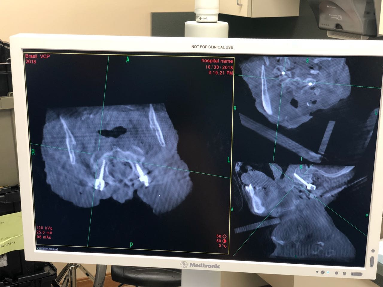 Participação como speaker em curso da Medtronic